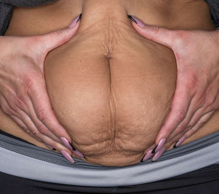 Closeup shot of overweight overweight woman measuring belly fat with hands.. Selective focusの写真素材