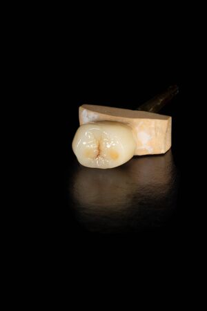 Dental veneers, ceramic and zirconium crowns of teeth close-up macro isolate on black background. Laboratory technical production  prosthesesの写真素材