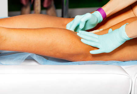Shugaring epilation, beautician in latex gloves applies paste and removes hair from female legs, close-up, copy space.の写真素材