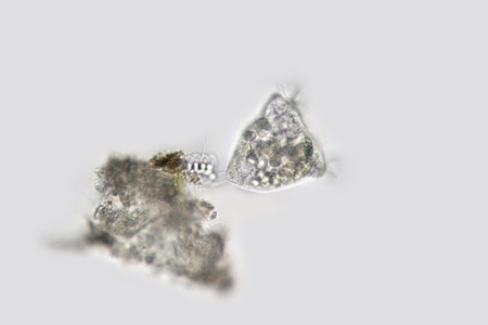 Vorticella campanula. Zooplanktonの写真素材