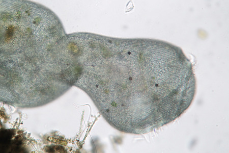 Microorganism changes its form. Stentor or trumpet animalcules is filter-feeding, heterotrophic protozoan ciliateの写真素材