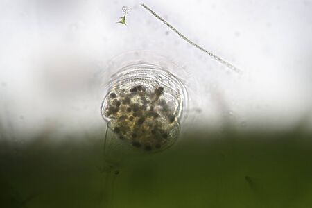 Freshwater Vorticella Campanula. Benthos by microscope. Zooplankton