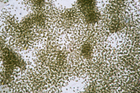Algal pollution by cyanobacteria Microcystis. Freshwater phytoplankton by microscope. Ecological...