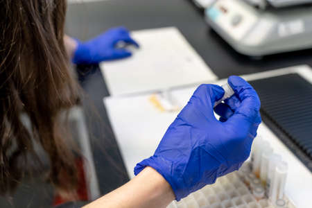 woman in laboratory doing tests for vaccine blood extraction and analyticalの写真素材