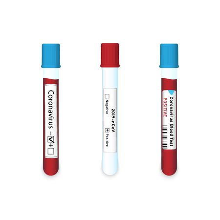 Coronavirus 2019-nCoV Blood Sample. Positive, Negative Blood Test Result. Empty Test Tube. The New Spreading Coronavirus. Epidemic Virus Respiratory Syndrome.のイラスト素材