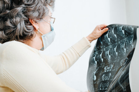 Elderly sick woman patient in medical face mask and glasses with x-ray picture of spine, close-up...