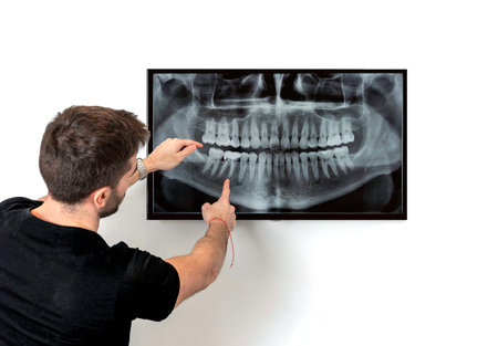 Two Doctors of Dentistry reviewing a panoramic x-ray of a dentureの写真素材