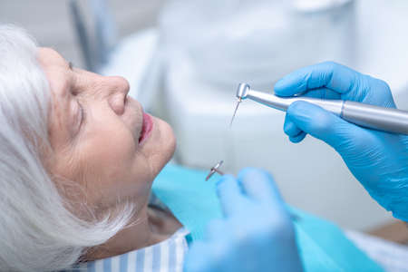 Dentist restoring teeth to the senior female patientの写真素材