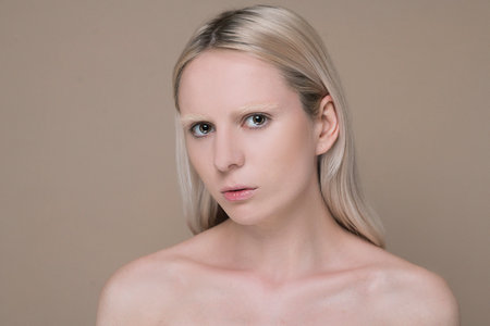 Waist up picture of a blonde girl with skin pigmentationの写真素材