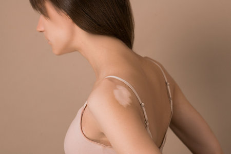 A waist up picrture of young pretty long-haired woman with skin pigmentationの写真素材