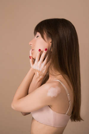 A young pretty long-haired woman with skin pigmentation closing her face with her handsの写真素材