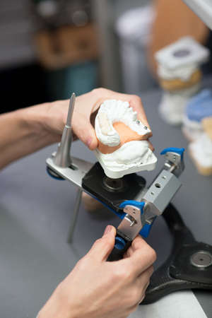 Prosthetist working with equipment at the dental clinicの写真素材