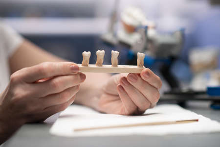 Close up picture of hands with dental prosthesisの写真素材