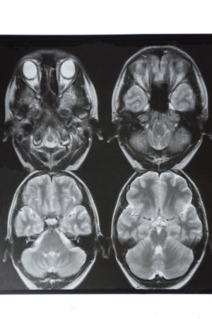 Macrophoto of computer tomography with the brain. Medical, scientific and educational MRI of the...
