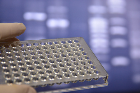 In the laboratory of medical genetics. Well plates in the hand of the scientist.