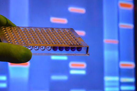 Laboratory DNA testing. Wells with biological samples on the background of electrophoretic gel.