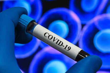 Blood testing for the coronavirus that causes COVID-19. A blood sample for testing for SARS-CoV-2.