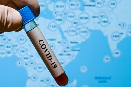The COVID-19 pandemic.  A test tube with a sample on the background of the incidence map.