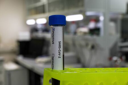 Coronavirus test. Test tube with sample for diagnosis COVID-19.