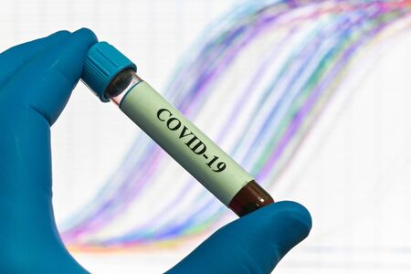 PCR diagnostics COVID-19. A test tube with a sample against the background of REAL-TIME PCR amplification curves.の写真素材