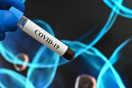 Coronavirus research. Laboratory study of the virus - the causative agent of COVID-19.