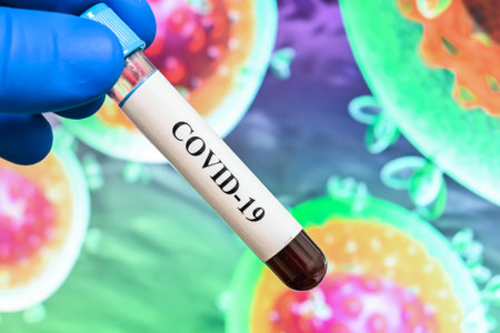 Coronavirus test. Detection of antibodies for COVID-19 in a blood sample.