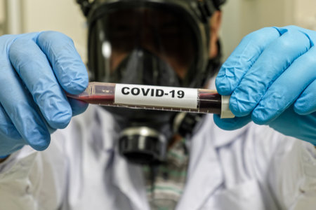 Coronavirus test. Detection of antibodies for COVID-19 in a blood sample.