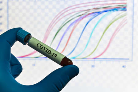 COVID-19 research. Testing a biological sample for coronavirus.の写真素材