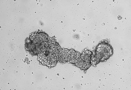 Spheroids of glioblastoma cell culture. Spheroidal structures of human malignant brain tumor cells...