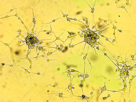 Spheroids of glioblastoma cell culture. Spheroidal structures of human malignant brain tumor cells under a microscope.の写真素材
