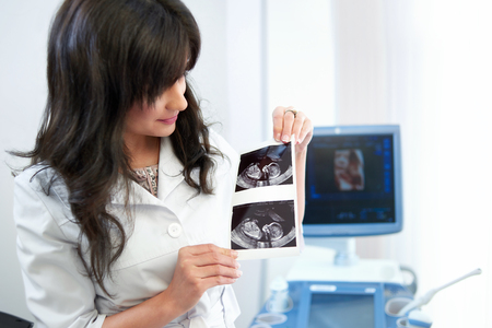 Beautiful female doctor sitting in her office near ultrasound scの写真素材