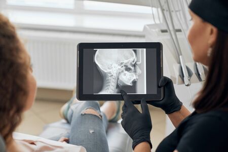 Selective focus of tablet with x ray picture of jaw in hands of professional female dentist. Doctor working in clinic and consulting young patient. Concept of medicine, care and treatment.の写真素材