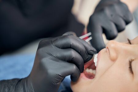 Close up of face of patient with opening mouth and hands of dentist in black rubber gloves. Doctor using metallic braces for alignment teeth of girl. Concept of health and beauty.の写真素材