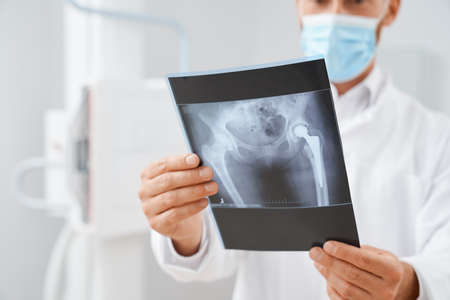 Close up of doctor wearing mask holding scan with result after ultrasound diagnostic of pelvis....