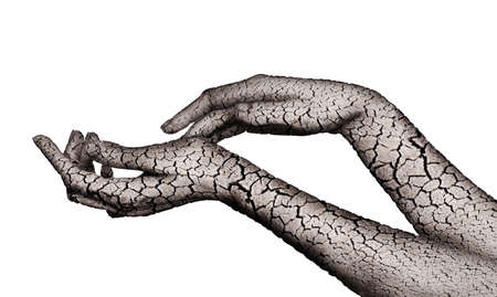 Concept of dry hands made of cracked soil show dryness of the skin of a womanの写真素材