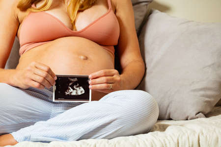 Close-up of pregnant woman hold baby ultrasoundの写真素材