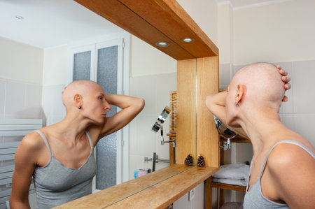 Woman with no hair contemplates her reflection in a mirrorの写真素材
