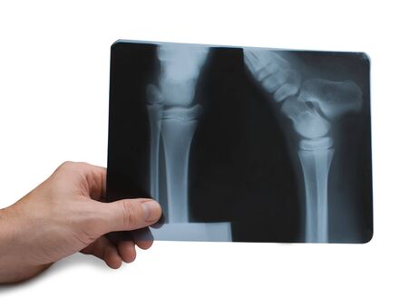 hand holds radiograph  isolated on a white backgroundの写真素材