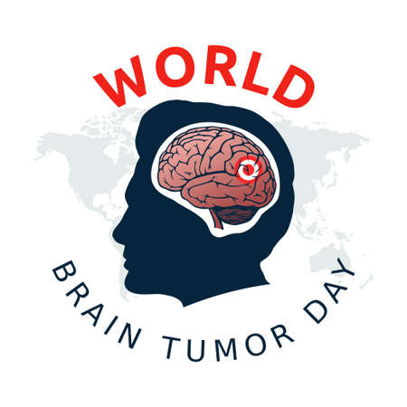 vector graphic of world brain tumor day good for world brain tumor day celebration. flat design. flyer design.flat illustration.のイラスト素材