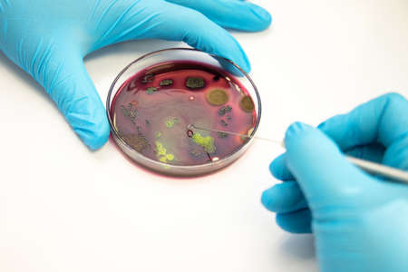 Scientist picking up colony of a red bacteria (Escherichia coli) from agar plate in a molecular...