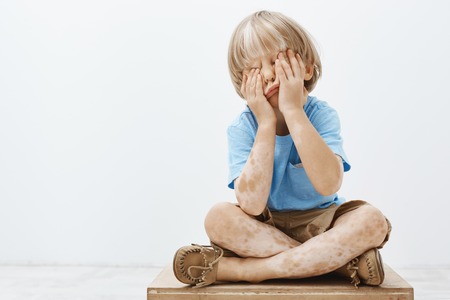 Indoor shot of cute european child with lovely haircut and vitiligo, covering face with palms while sitting, playing hide and seek with older brother, having fun and feeling carefree over gray wallの写真素材