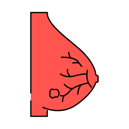 lobular breast cancer icon color illustrationのイラスト素材