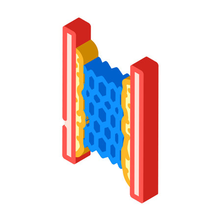 stent placement surgery isometric icon vector illustrationのイラスト素材