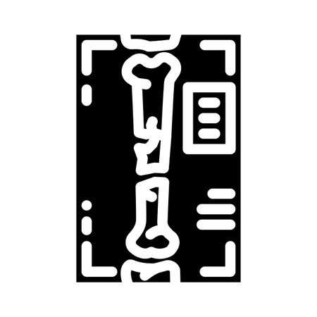 x ray fracture injury glyph icon vector illustrationのイラスト素材
