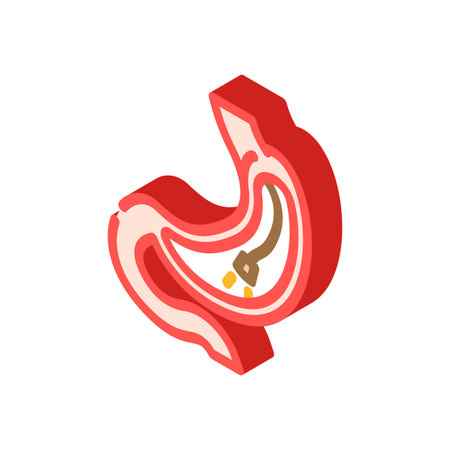 gastroscopy procedure gastroenterologist isometric icon vector illustrationのイラスト素材