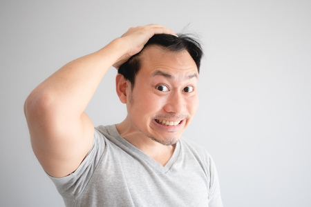 Shocked face of Asian man find himself lost hair and get bald in grey t-shirt.の写真素材