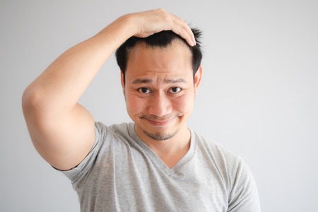 Shocked face of Asian man find himself lost hair and get bald in grey t-shirt.の写真素材