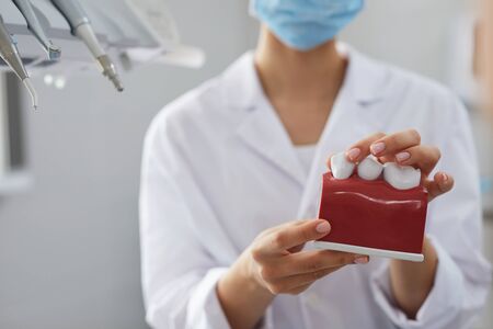 Closeup female dentist holding tooth model while consulting patient in clinic, copy spaceの写真素材