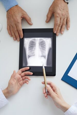 Close up of unrecognizable senior man listening to female doctor and looking at lung x-ray image on table during consultation in clinicの写真素材
