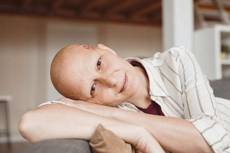 Minimal close up portrait of bald adult woman smiling at camera while lounging on couch in warm-toned home interior, alopecia and cancer awareness, copy spaceの写真素材